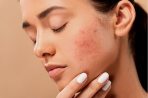 Verzorg je huid zonder gevaar voor irritaties